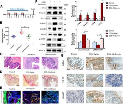 Metformin Ameliorates Chronic Colitis-Related Intestinal Fibrosis via Inhibiting TGF-β1/Smad3 Signaling